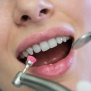 Close-up of a person at the dentist with an open mouth, showing dental tools cleaning their teeth.