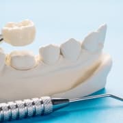 A dental model with a crown being placed on a tooth, next to dental tools, against a light blue background.
