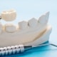 A dental model with a crown being placed on a tooth, next to dental tools, against a light blue background.