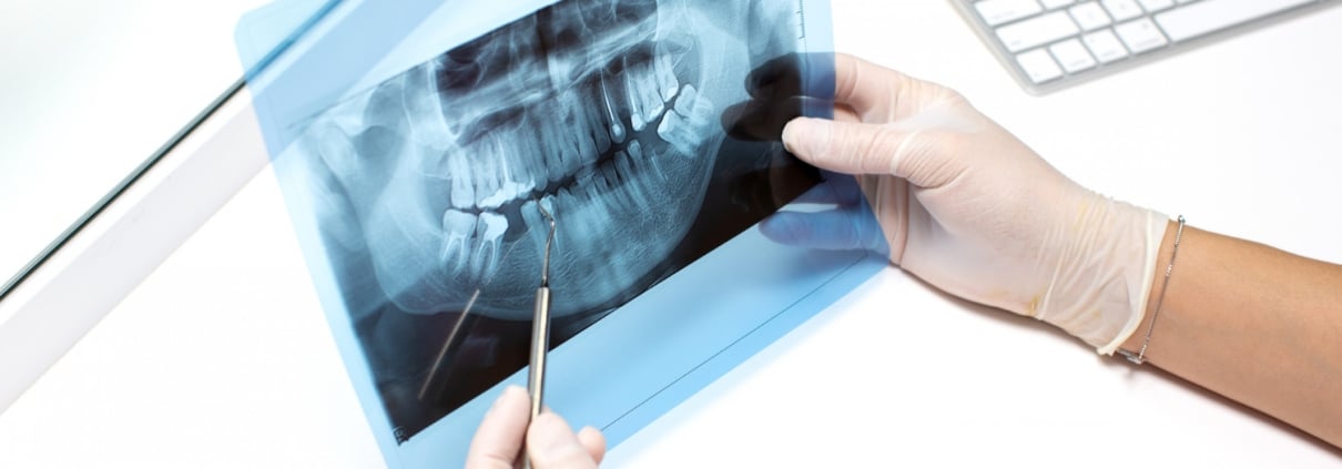 A gloved person holds a dental X-ray and uses a dental probe to point at a specific area; a keyboard is visible on the desk.
