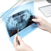 A gloved person holds a dental X-ray and uses a dental probe to point at a specific area; a keyboard is visible on the desk.