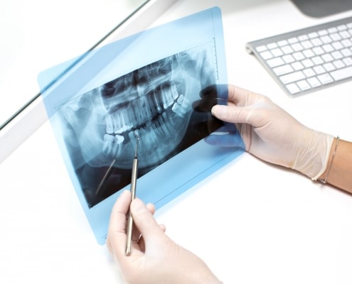 A gloved person holds a dental X-ray and uses a dental probe to point at a specific area; a keyboard is visible on the desk.