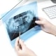 A gloved person holds a dental X-ray and uses a dental probe to point at a specific area; a keyboard is visible on the desk.