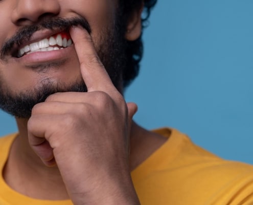 A person in a yellow shirt lifts their upper lip with a finger to show their teeth and gums against a blue background.